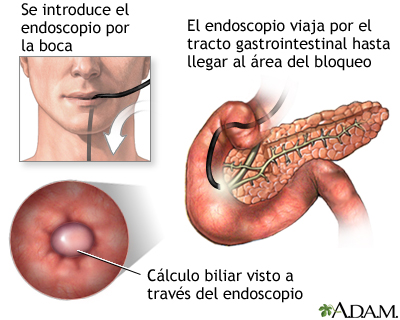 Procedimiento Procedimiento