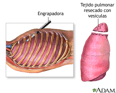 Cuidados postoperatorios Cuidados postoperatorios