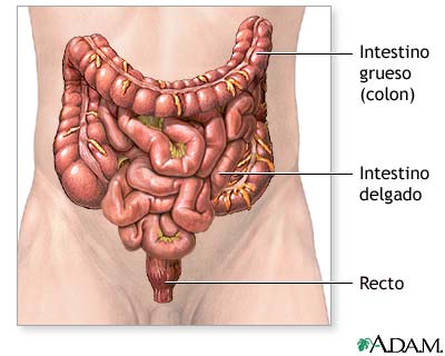 Cáncer de colon - serie Cáncer de colon - serie