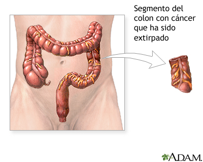 Procedimiento Procedimiento