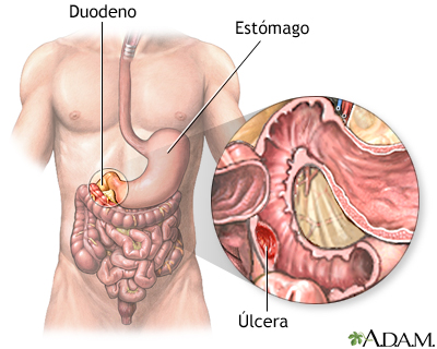 Indicaciones Indicaciones