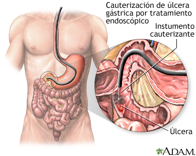 Procedimiento (segunda parte) Procedimiento (segunda parte)
