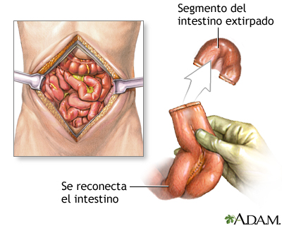 Procedimiento Procedimiento