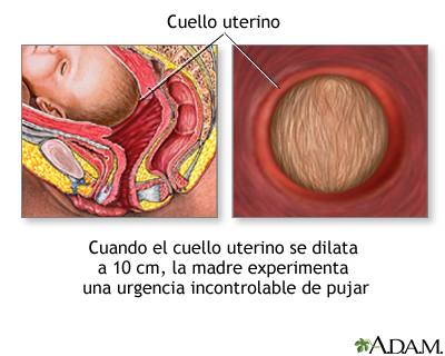 Parto de emergencia Parto de emergencia