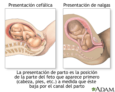 Presentaciones de parto Presentaciones de parto
