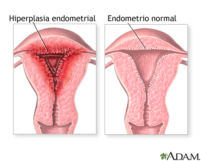 Periodos menstruales anormales Periodos menstruales anormales