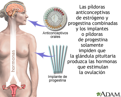 Anticonceptivos a base de hormonas Anticonceptivos a base de hormonas