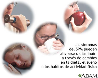 Alivio del SPM Alivio del SPM
