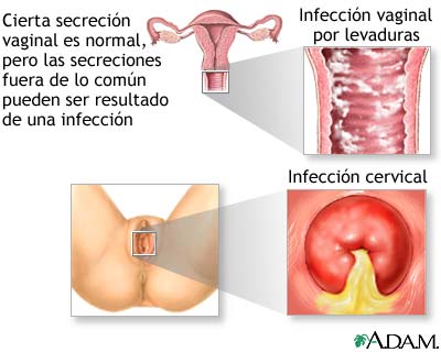 Secreción vaginal Secreción vaginal