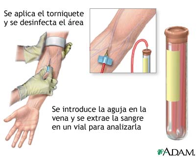 Examen de sangre PSA Examen de sangre PSA
