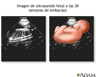 Ultrasonido a las 30 semanas Ultrasonido a las 30 semanas