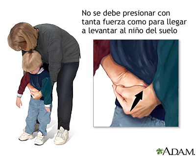 Maniobra de Heimlich en niños conscientes Maniobra de Heimlich en niños conscientes