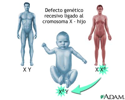 Defectos genéticos recesivos ligados al X - cómo se ven afectados los niños Defectos genéticos recesivos ligados al X - cómo se ven afectados los niños