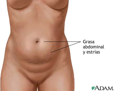 Abdominoplastia - serie Abdominoplastia - serie