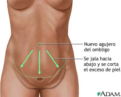 Procedimiento (tercera parte) Procedimiento (tercera parte)