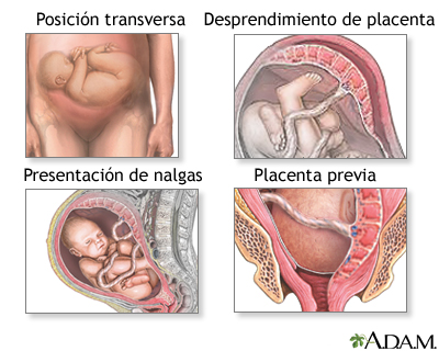 Indicaciones Indicaciones