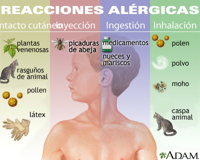 Reacciones alérgicas Reacciones alérgicas