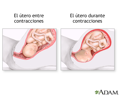 Procedimiento (segunda parte)