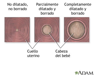 Procedimiento (tercera parte) Procedimiento (tercera parte)