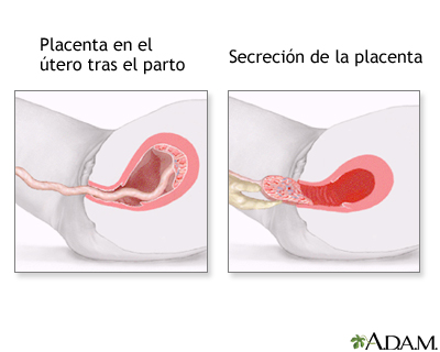 Procedimiento (séptima parte) Procedimiento (séptima parte)