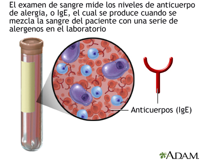 Prueba RAST Prueba RAST