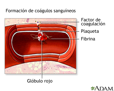 Formación de coágulos sanguíneos Formación de coágulos sanguíneos