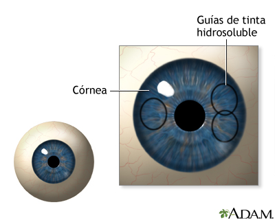 Procedimiento, parte 1 Procedimiento, parte 1