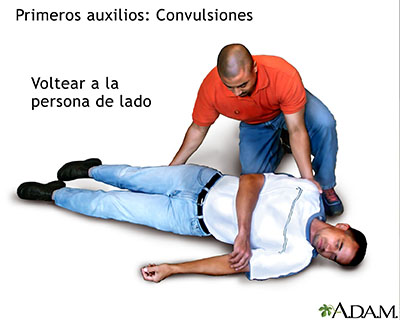 Primeros auxilios para convulsiones, parte 2 Primeros auxilios para convulsiones, parte 2