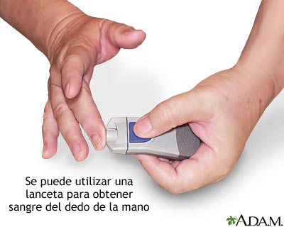 Medición del nivel de glucosa en la sangre - Pínchese el dedo Medición del nivel de glucosa en la sangre - Pínchese el dedo