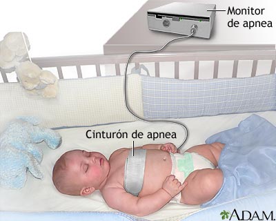 Monitor de apnea Monitor de apnea