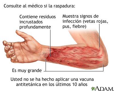 Raspadura Raspadura