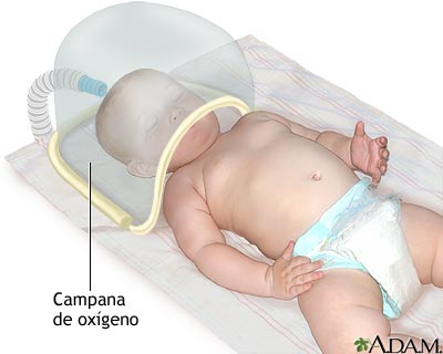 Campana de oxígeno Campana de oxígeno