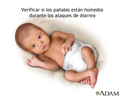 Diarrea y pañales Diarrea y pañales