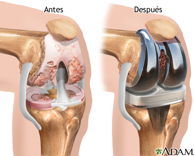 Cuidados postoperatorios Cuidados postoperatorios