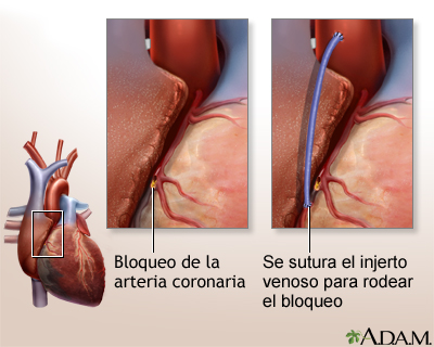 Cuidados postoperatorios Cuidados postoperatorios