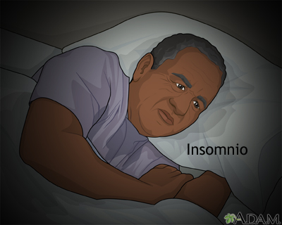 Depresión e insomnio Depresión e insomnio