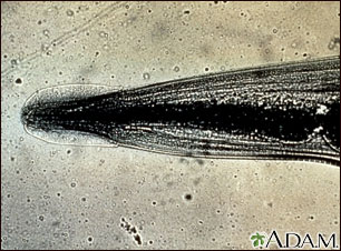 Lombriz intestinal - primer plano de la cabeza Lombriz intestinal - primer plano de la cabeza