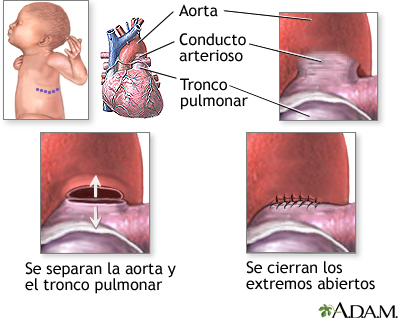 Procedimiento Procedimiento