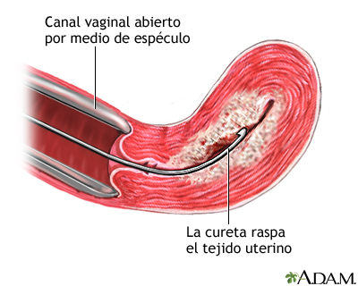 Procedimiento Procedimiento