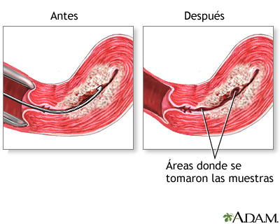 Cuidados postoperatorios Cuidados postoperatorios
