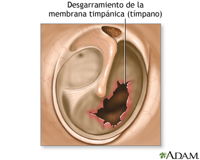 Indicaciones Indicaciones