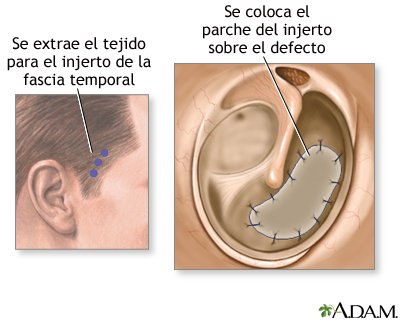 Procedimiento Procedimiento
