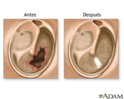 Cuidados postoperatorios Cuidados postoperatorios