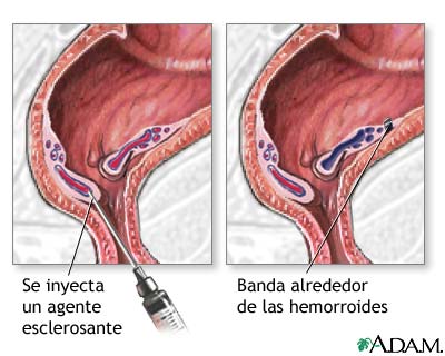 Procedimiento Procedimiento
