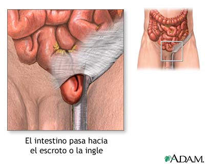 Indicaciones Indicaciones