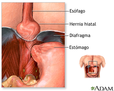 Indicaciones Indicaciones
