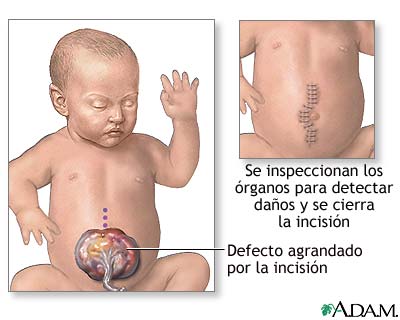 Procedimiento Procedimiento