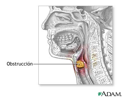Indicaciones Indicaciones