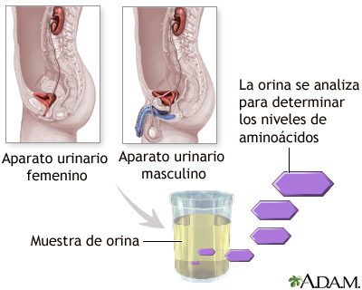 Prueba de aminoaciduria en orina Prueba de aminoaciduria en orina