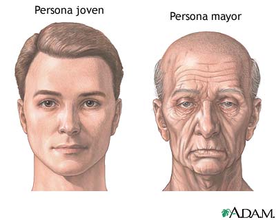 Cambios de la cara por envejecimiento Cambios de la cara por envejecimiento